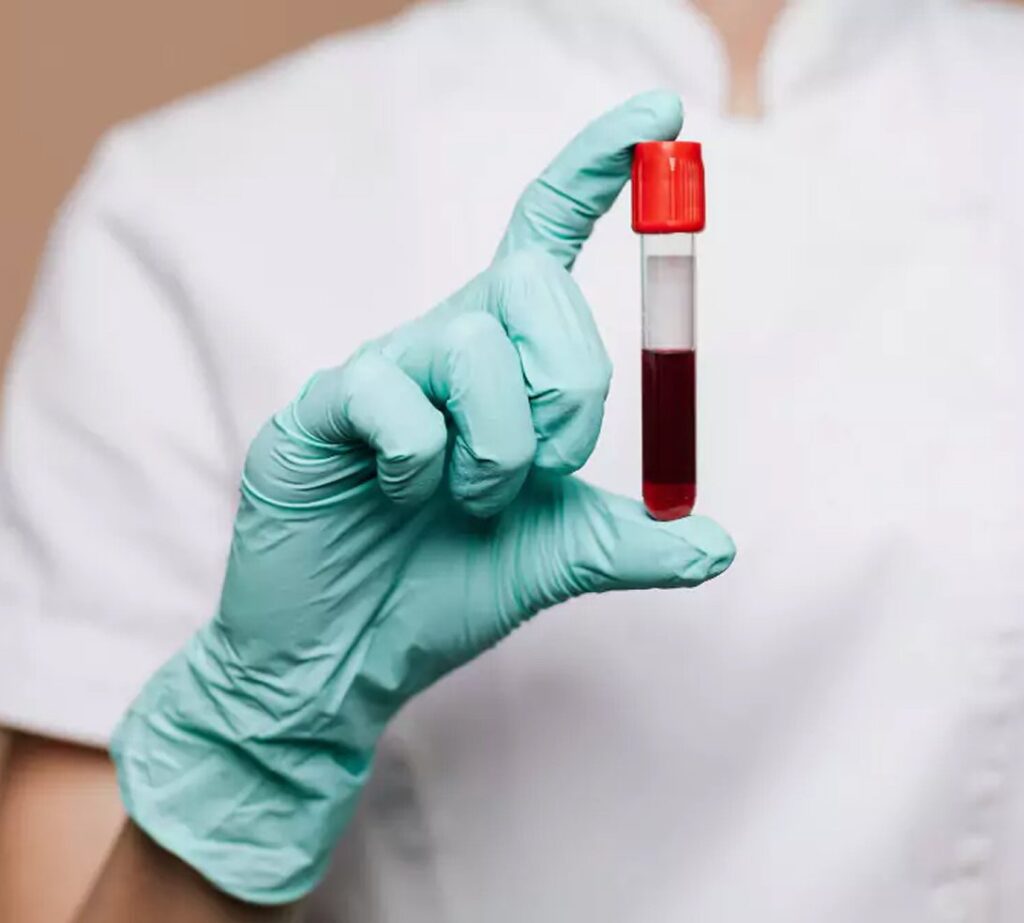 Haematology Img