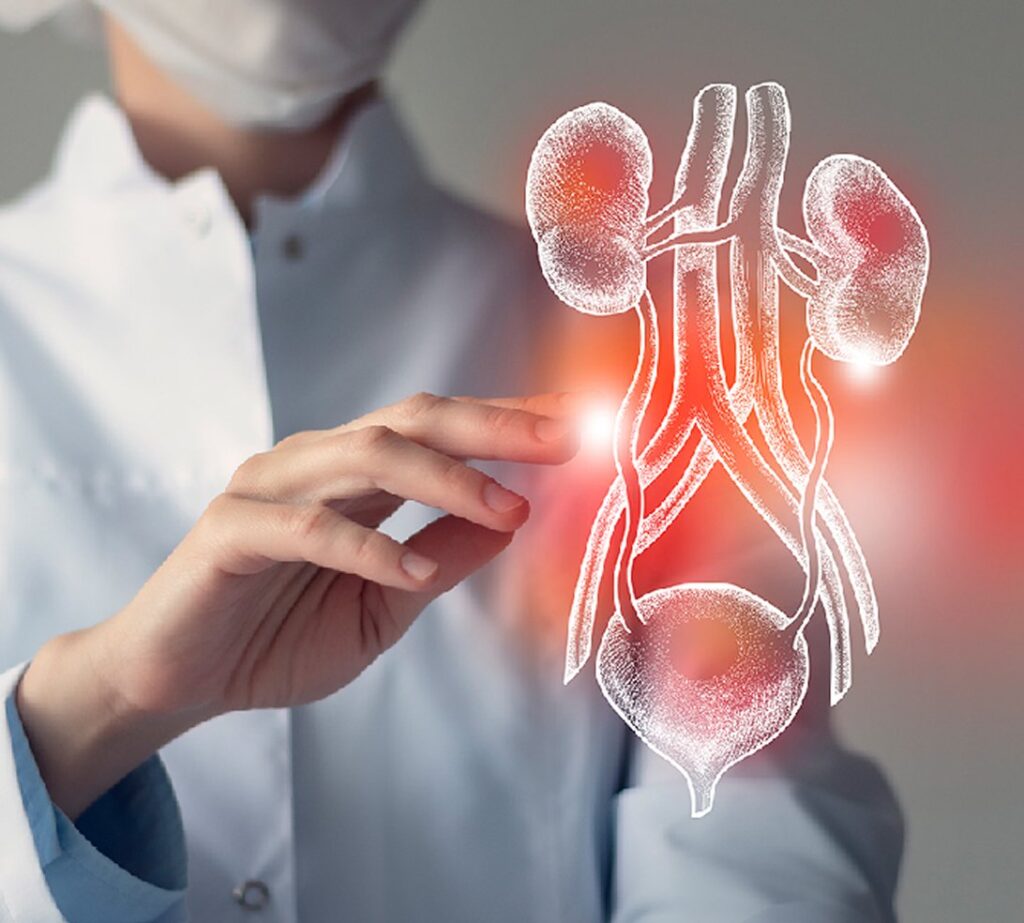 Nephrology Img