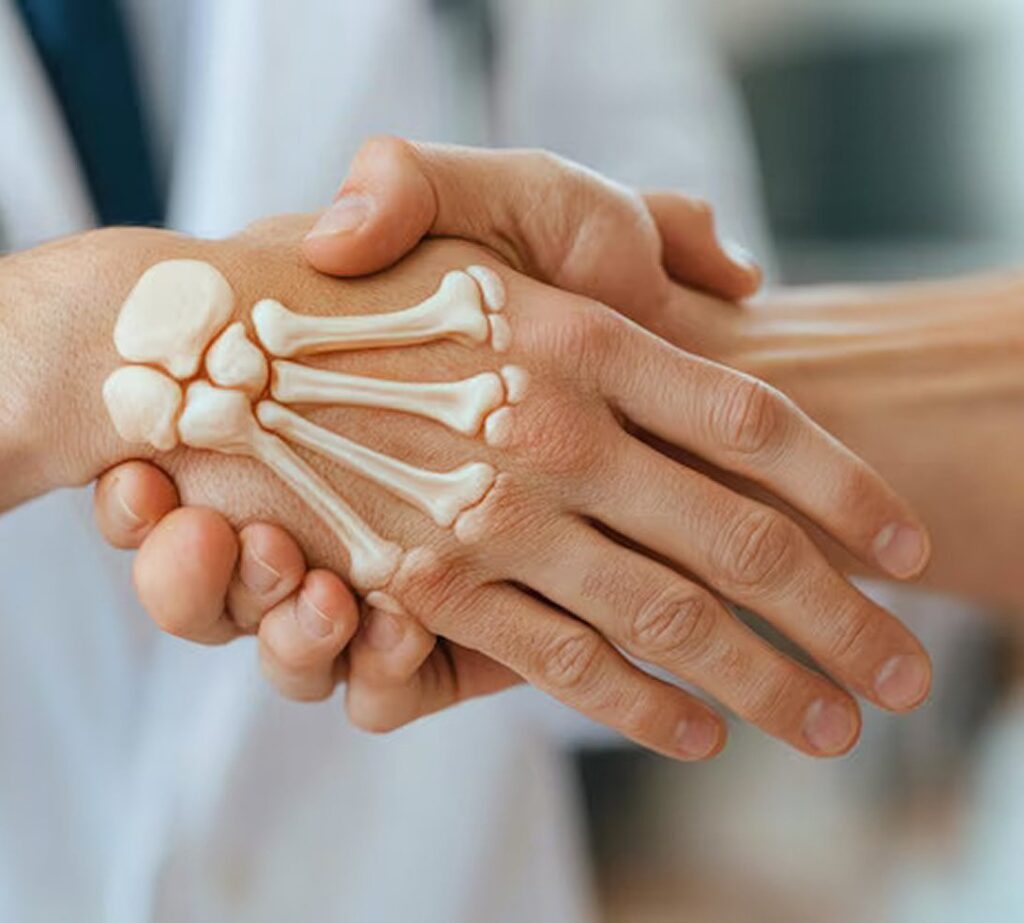 Rheumatology Img